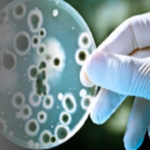 CONTROL MICROBIOLÓGICO